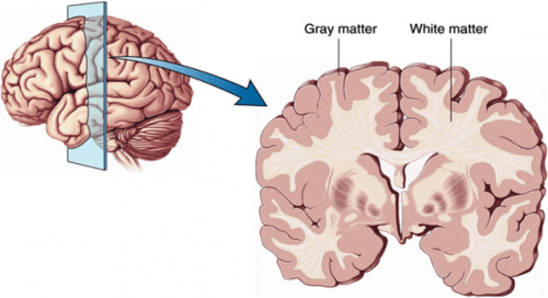 Image result for gray matter brain diagram