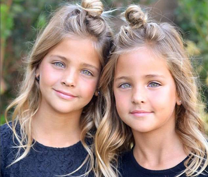 This Couple Gave Birth To The Most Beautiful Pair Of Twins Look Where They Are Now Page 3 Of 