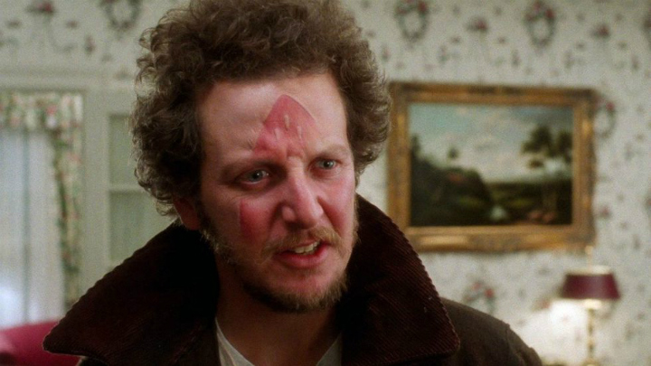 Wet Bandits Injuries - Home Alone