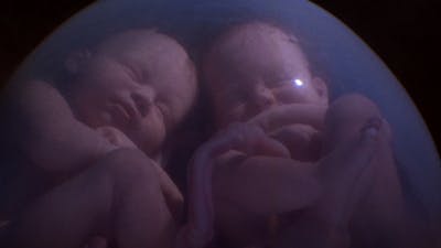 Image result for twins womb